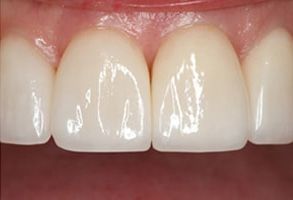 Unident Group PC | ClearCorrect reg , Pediatric Dentistry and Teeth Whitening