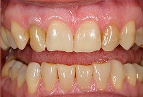 Unident Group PC | Periodontal Treatment, Orthodontics and ClearCorrect reg