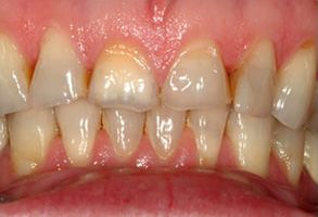 Unident Group PC | Invisalign reg , Extractions and ClearCorrect reg